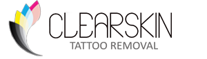 Remoción de tatuajes en
Toluca - CLEARSKIN