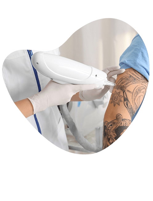 remocion-de-tatuajes-certificado.png